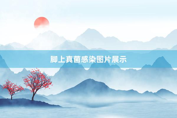 脚上真菌感染图片展示